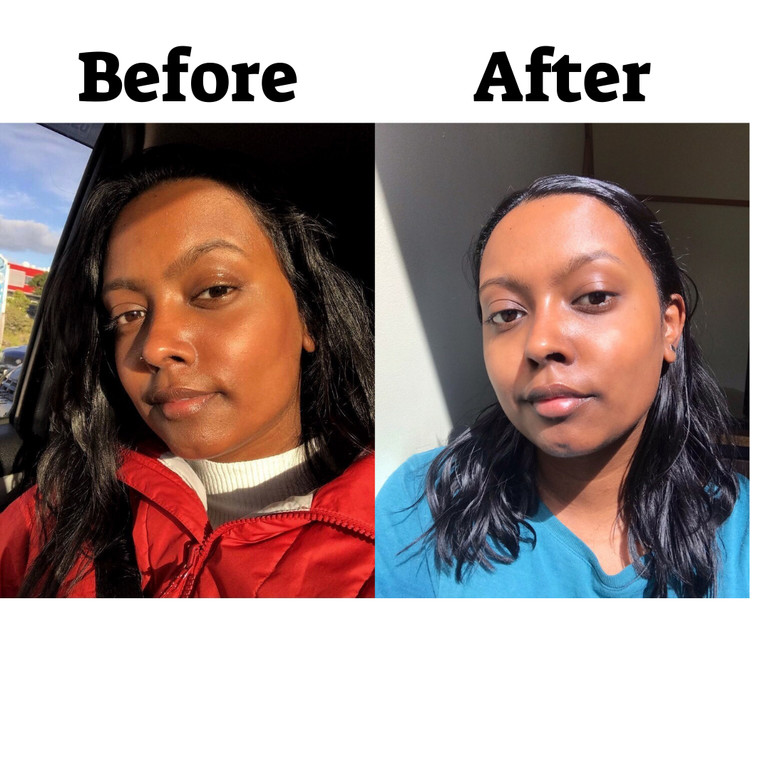 Before & After Pigmentation