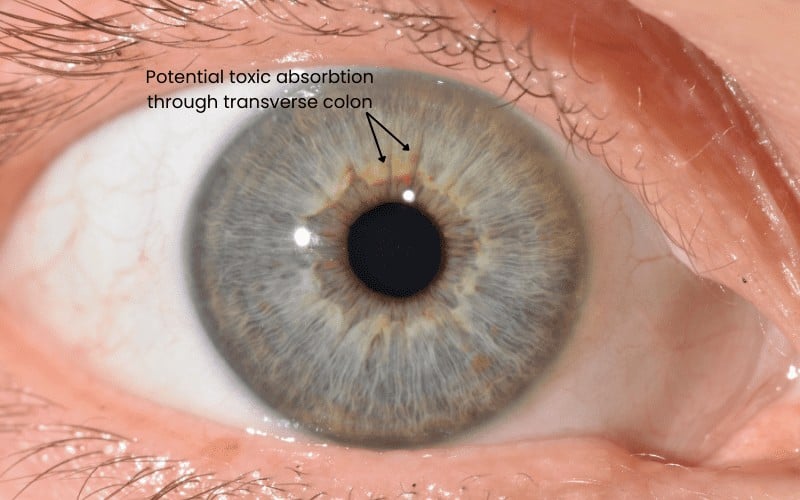Iris Examples Health Saves