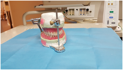 Dental Implants in Arcadia