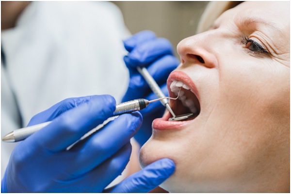 West Hollywood Root canals