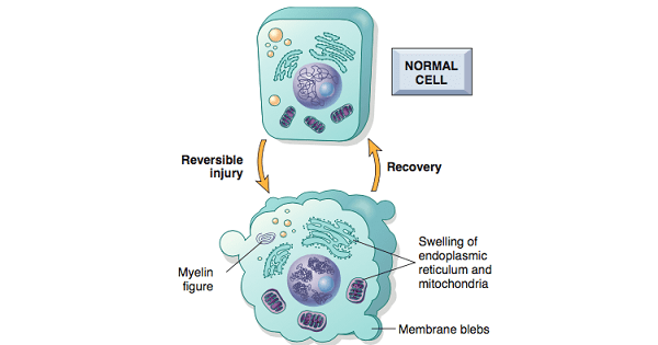 Reversible Cell Injury