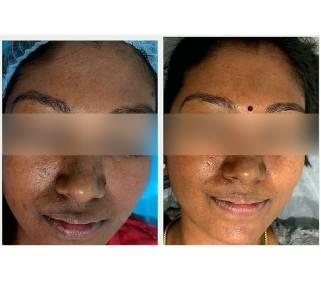 skin-service-before-after