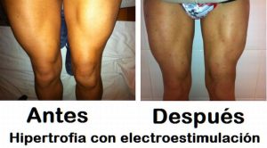 Electroestimulación en lesiones de rodilla