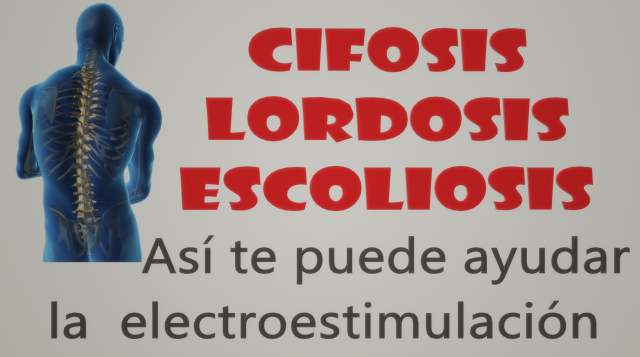 La electroestimulación puede ayudar con la cifosis, la escoliosis y la lordosis